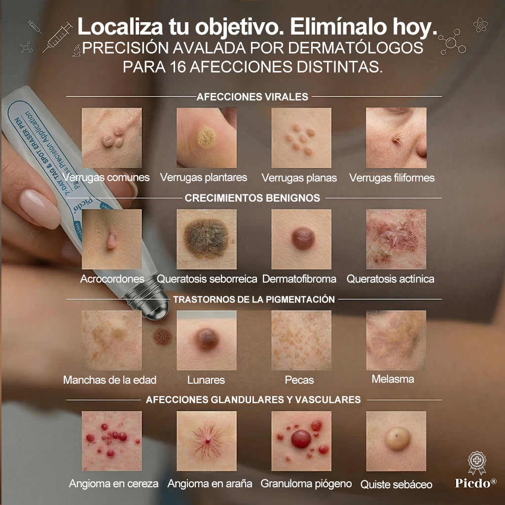 🇺🇸 𝐏i𝐜𝐝o® 𝟕 𝐃í𝐚𝐬 𝐋á𝐩𝐢𝐳 𝐏𝐚𝐫𝐚 𝐄𝐥𝐢𝐦𝐢𝐧𝐚𝐫 𝐋𝐮𝐧𝐚𝐫𝐞𝐬 𝐘 𝐌𝐚𝐧𝐜𝐡𝐚𝐬(Roll-on Cero Dolor, Cero Cicatrices)